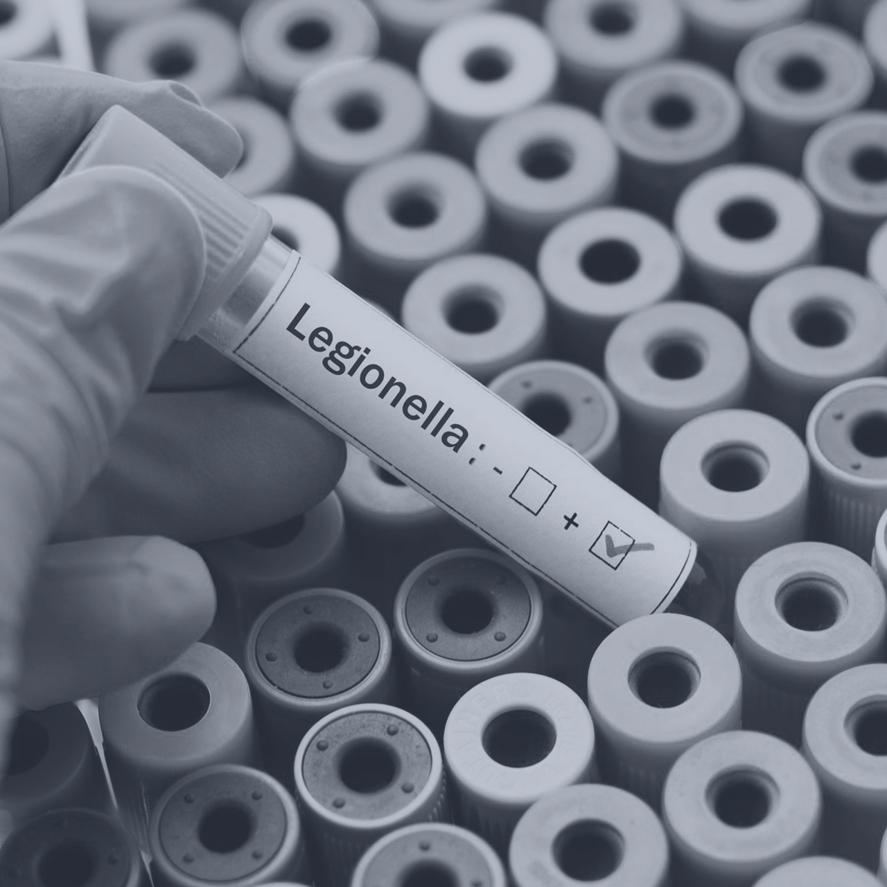 legionella test i hånden på laborant